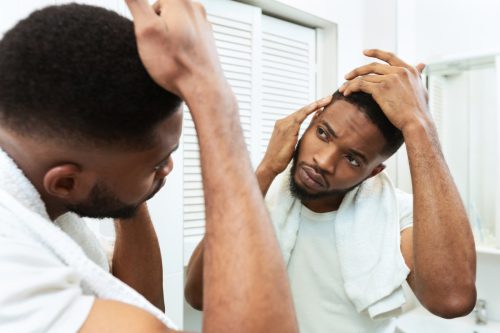 man looking in mirror at his head, hairloss