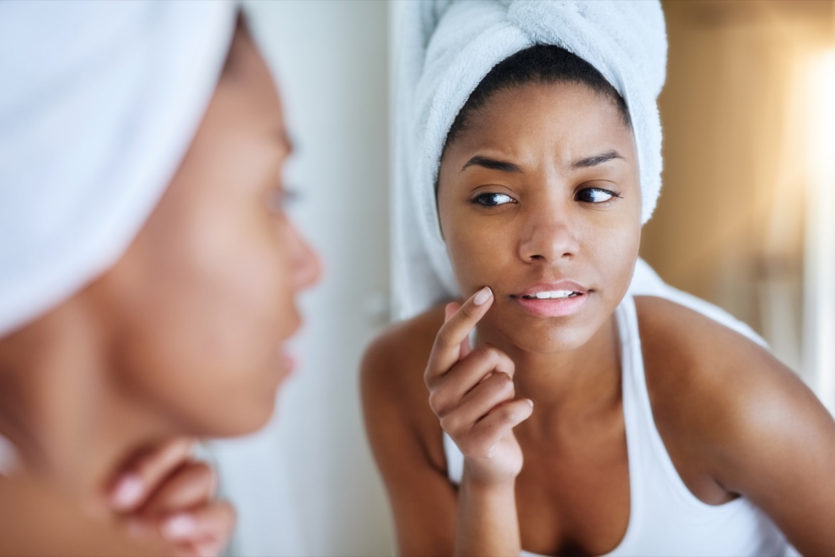 Fotografie cu o tânără care își examinează pielea în fața oglinzii din baie, arătând supărată