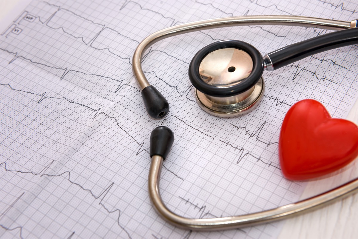 Stethoscope and cardiogram