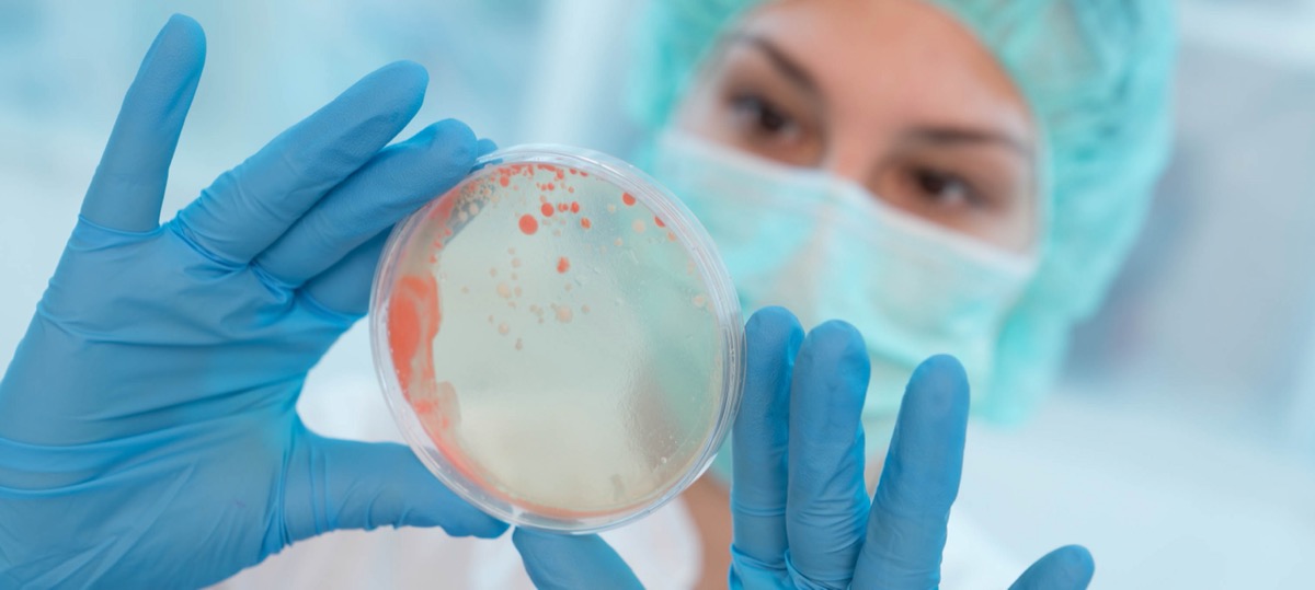 scientist holding petri dish