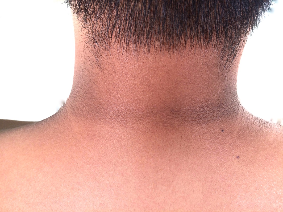 волосы на шее и груди у женщин фото 119