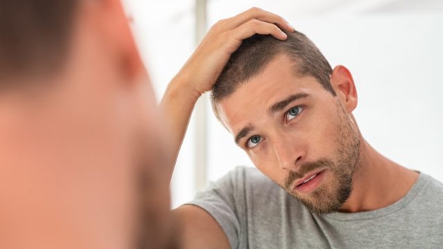 Young handsome man looking at scalp in mirror