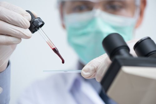 Ein Laborant legt eine Blutprobe auf einen Objektträger