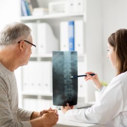 Doctor reviewing spinal x-ray
