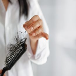 woman losing hair on hairbrush
