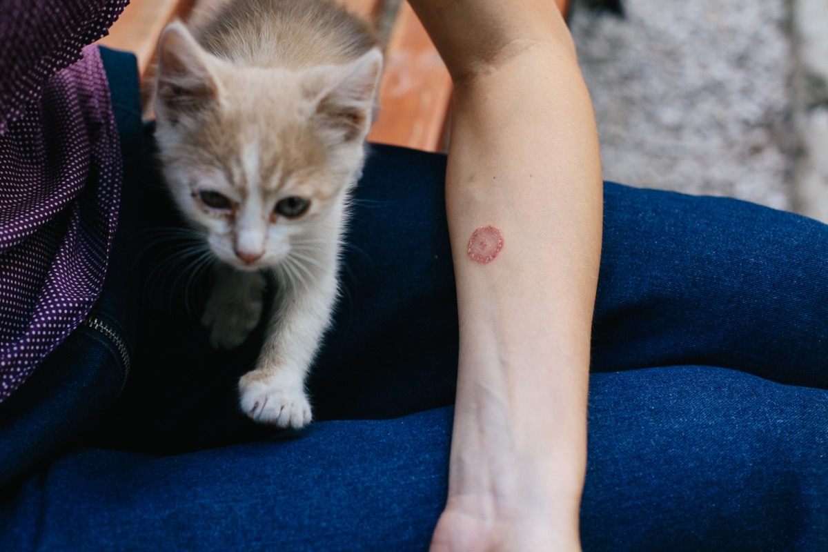 Cat owner with ringworm on arm