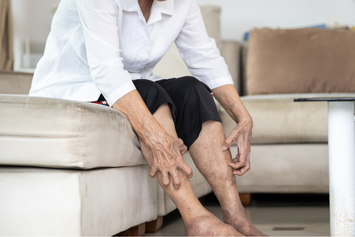 older woman scratching her lower legs