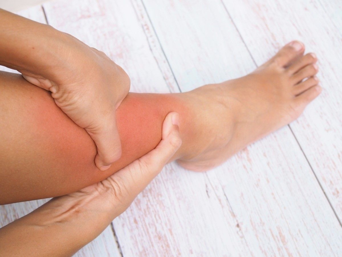 Person Holding Red and Swollen Leg