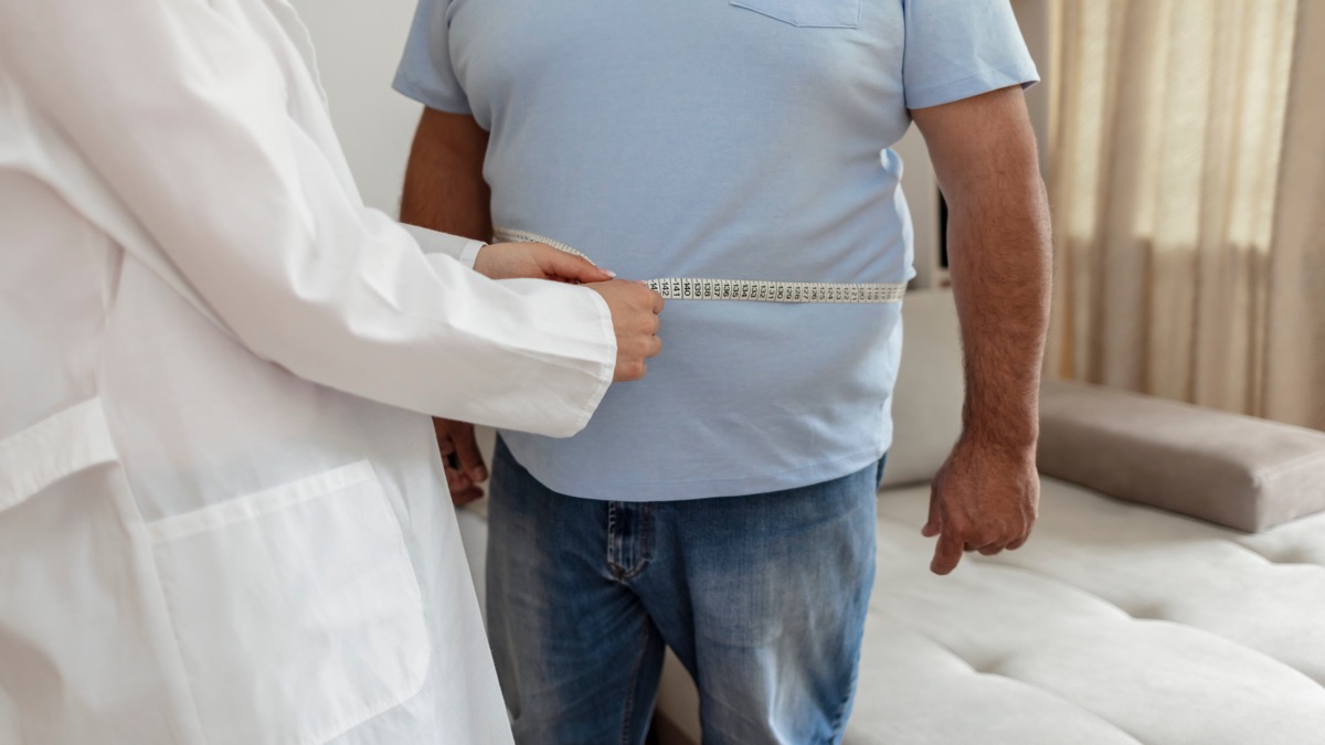 A nutritionist doctor measures the body of a male patient with a measuring tape on adipose tissue and excess weight. Overweight obesity man seeing doctor for treatment of his illness and weight loss.
