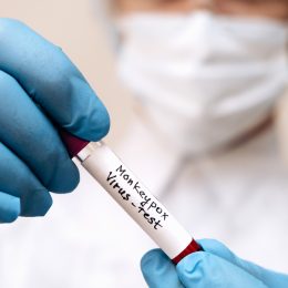 A lab technician holding a blood sample for a monkeypox test