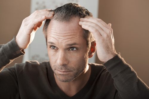 man looking at hairline