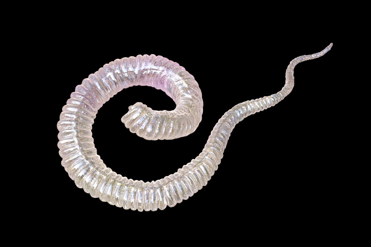 Dracunculus medinensis, ή σκουλήκι της Γουινέας, προνύμφη πρώτου σταδίου, τρισδιάστατη απεικόνιση.  Οι προνύμφες εκκρίνονται από το θηλυκό σκουλήκι που παρασιτίζει κάτω από το δέρμα των ανθρώπινων άκρων σε ασθενείς με dracunculiasis