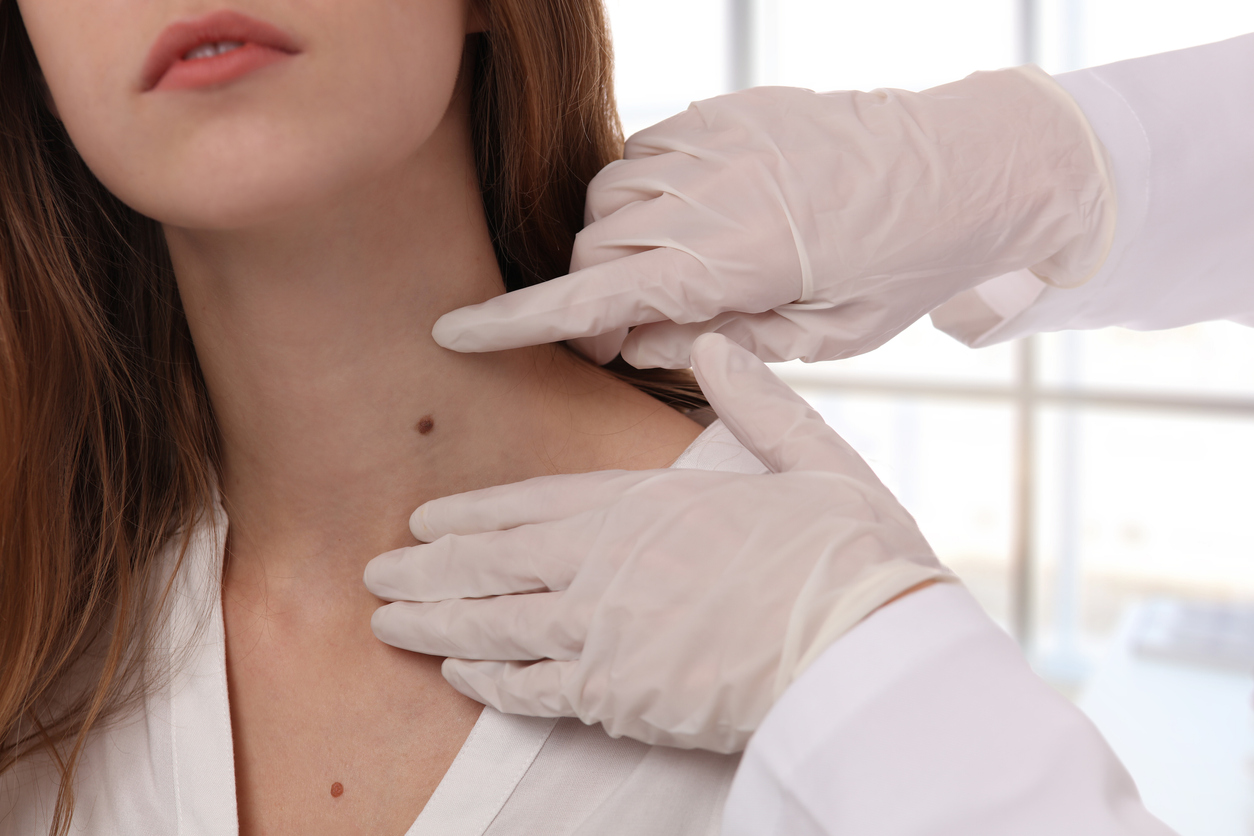 Doctor examining a mole on a patient's neck.
