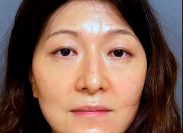 California Dermatologist Arrested For "Poisoning Her Husband" After He Set Up Camera to Prove It