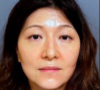 California Dermatologist Arrested For "Poisoning Her Husband" After He Set Up Camera to Prove It