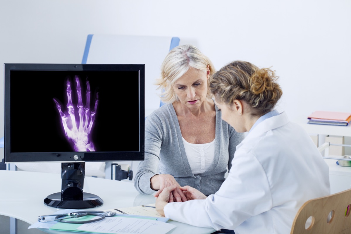 patient and doctor consulting about arthritis