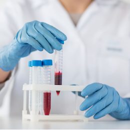 Laboratory-Grown Blood Has Been Put Into People in a First Clinical Trial