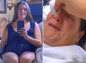 Heart-Melting Moment Woman Who Lost 350 Pounds Bursts Into Tears of Joy After Surgically Removing 47 Pounds of Excess Skin. "I Deserve to Be Happy."