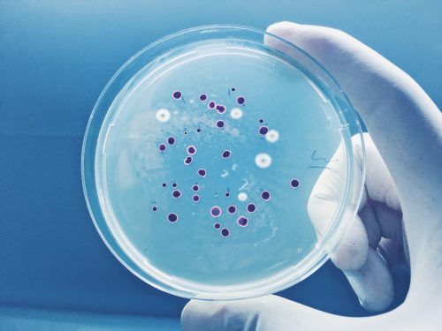 Agar plate full of micro bacterias and microorganisms