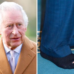 King Charles Suffers Embarrassing Wardrobe Malfunction on Official Visit