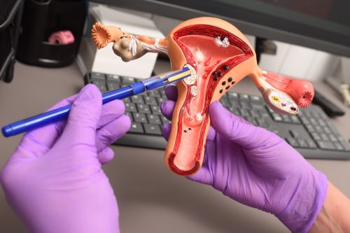 model of a human uterus