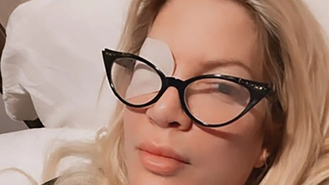 Tori Spelling wearing an eye patch in a post on her Instagram Story