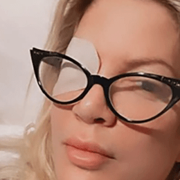 Tori Spelling wearing an eye patch in a post on her Instagram Story