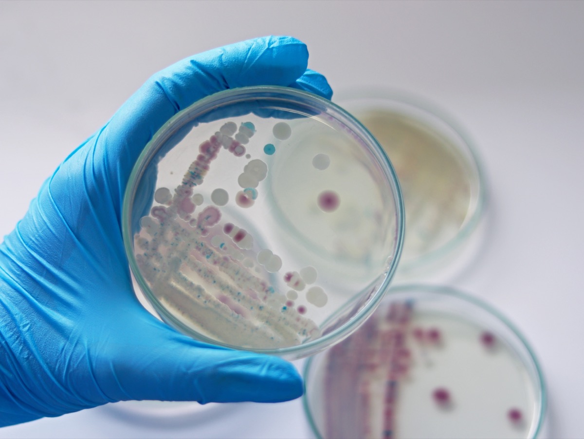 researcher holding petri dish of vibrio vulificus