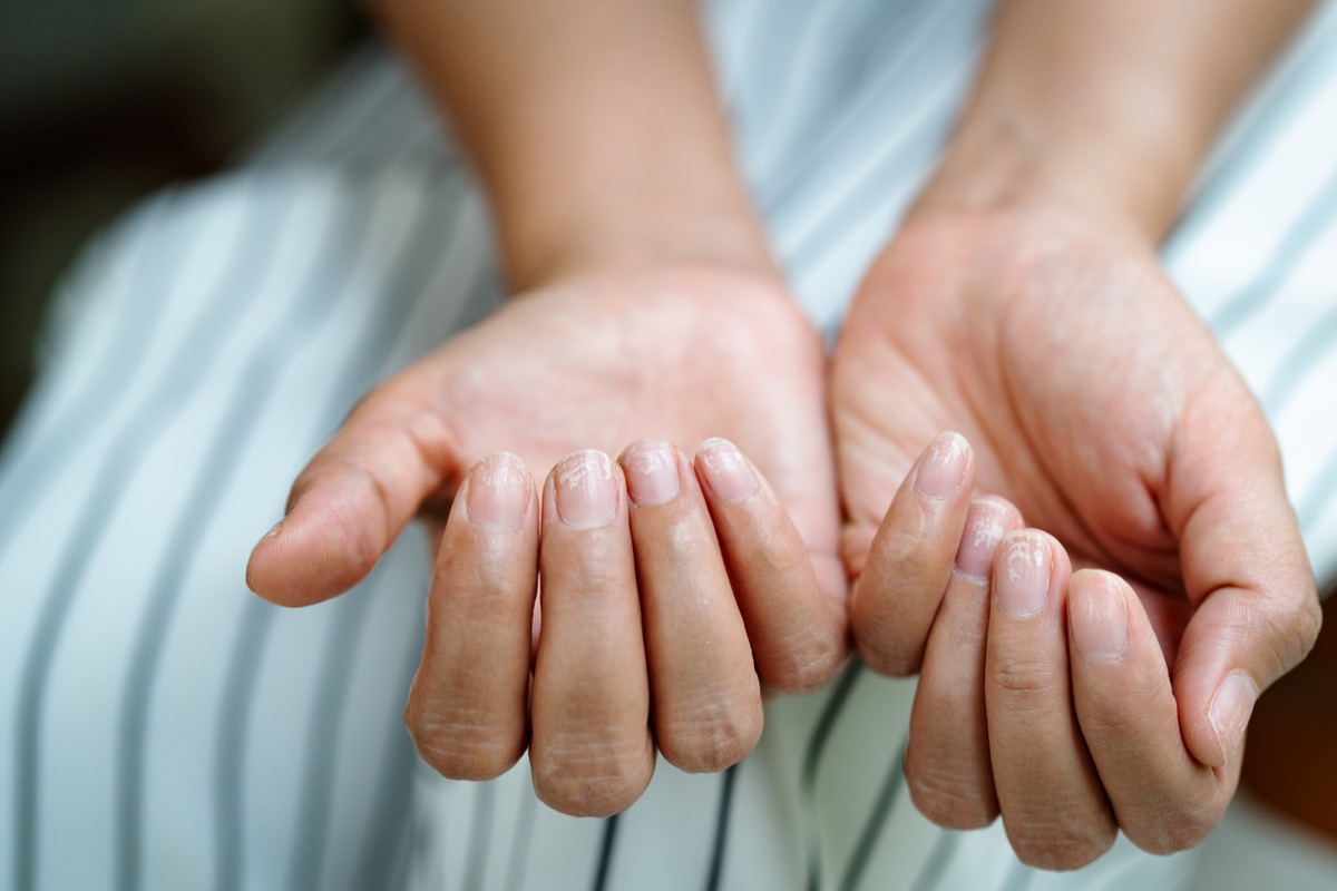 Closeup of woman looking at her finger nails