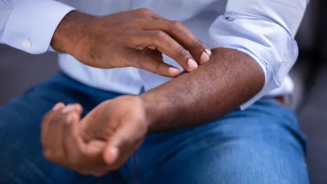 man checking for rash on arm