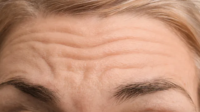 Close up of a female forehead with wrinkles