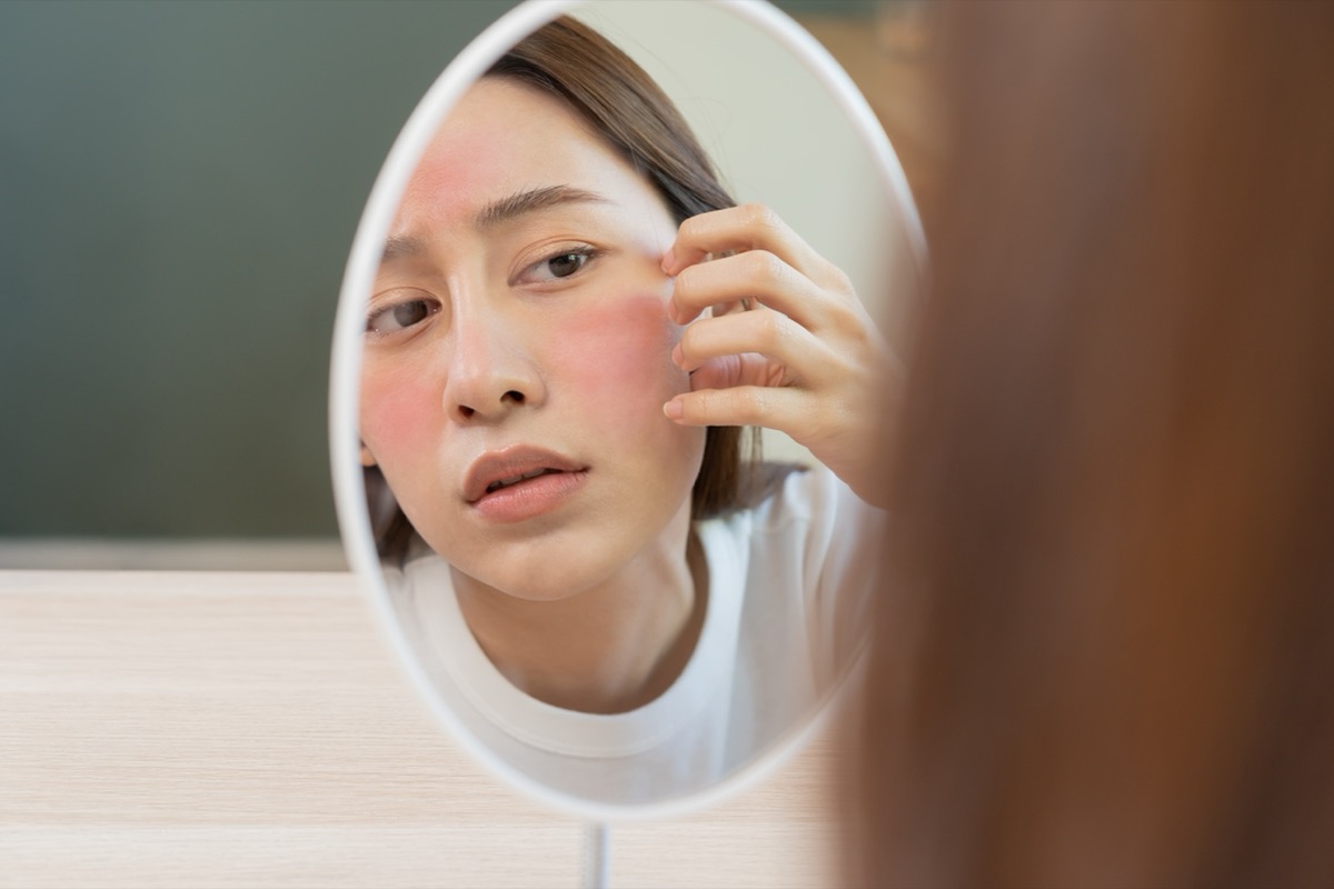 Young woman looking into the mirror at red, irritated skin