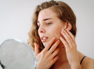 A woman looking in a mirror, touching her face, which is breaking out