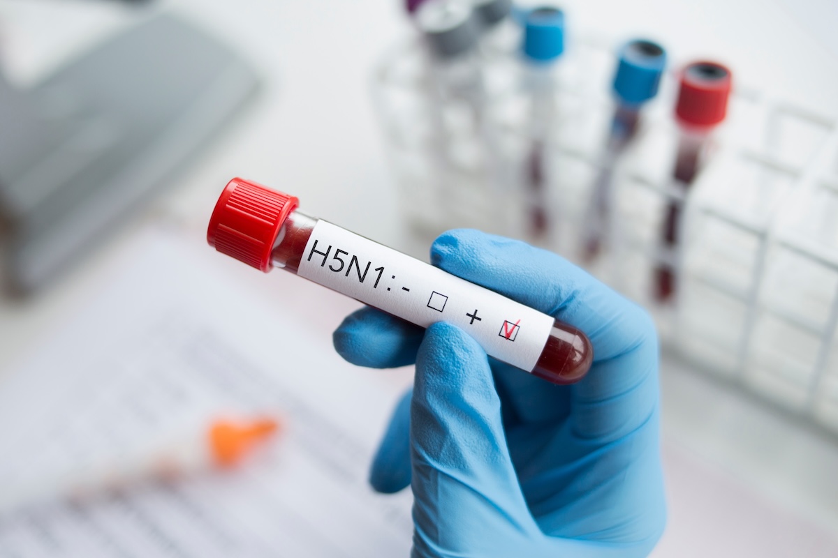Blood sample positive with H5N1 influenza virus.