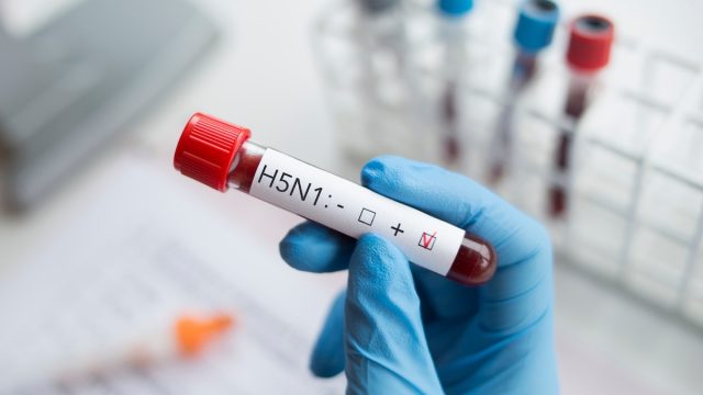 Blood sample positive with H5N1 influenza virus.