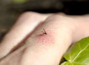 21 Americans Infected With Mosquito-Borne "Sloth Fever"—5 Symptoms to Know