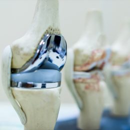 Can You Delay a Knee Replacement? New Treatment Approach May Eliminate Pain