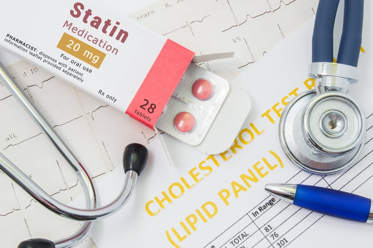 Most People Over 70 Should Consider Taking Statins, New Research Says