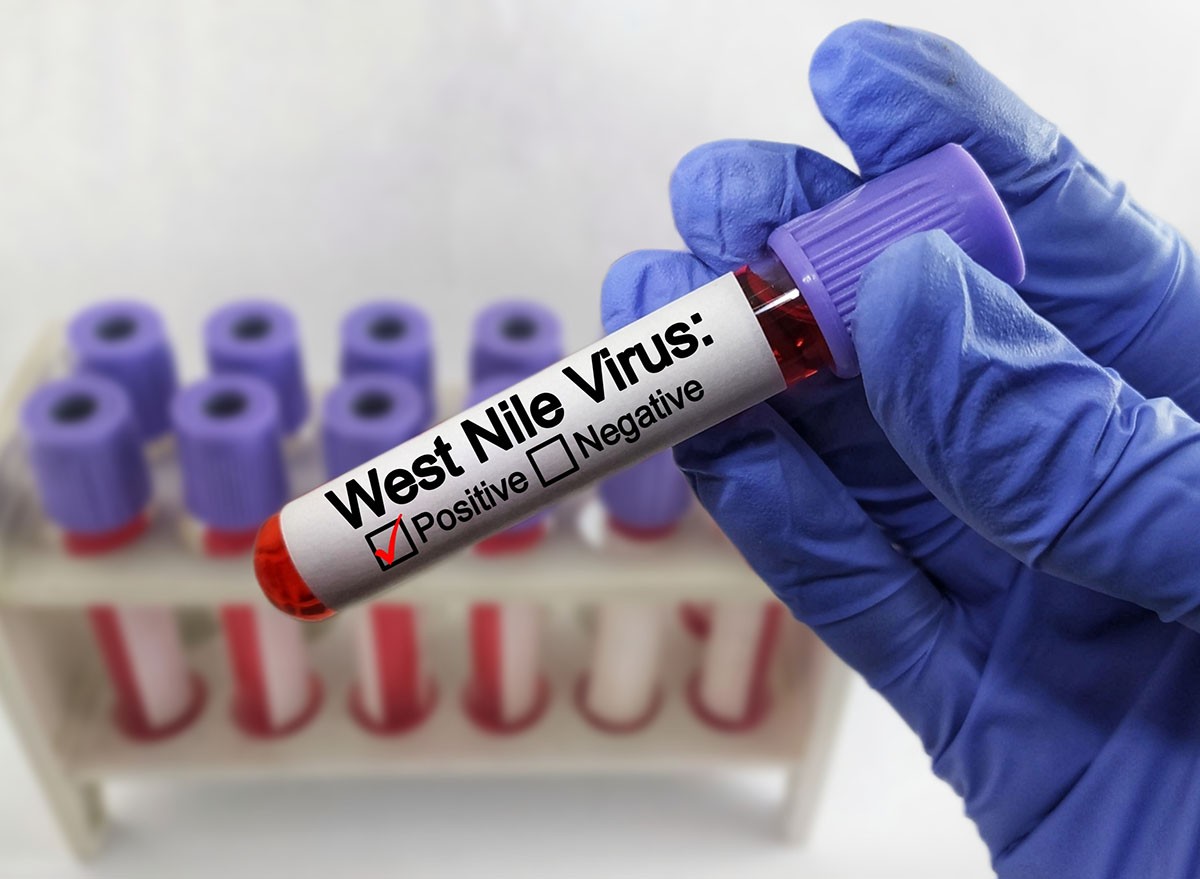 A blood test, testing positive for West Nile Virus