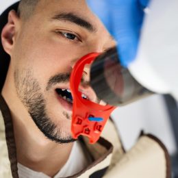 Do You Really Need Dental X-Rays? Some Doctors Say No