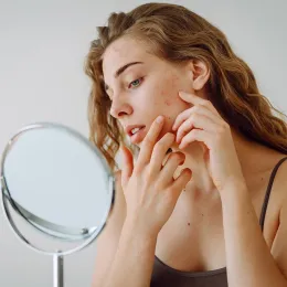 Dermatologists Warn About the No. 1 Cause of Adult Acne