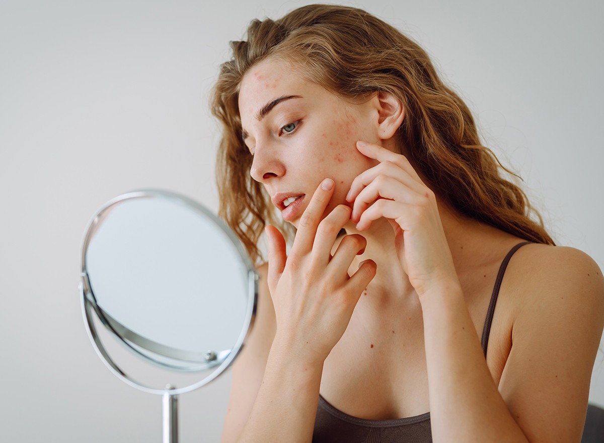 A woman with skin problems looks in the mirror