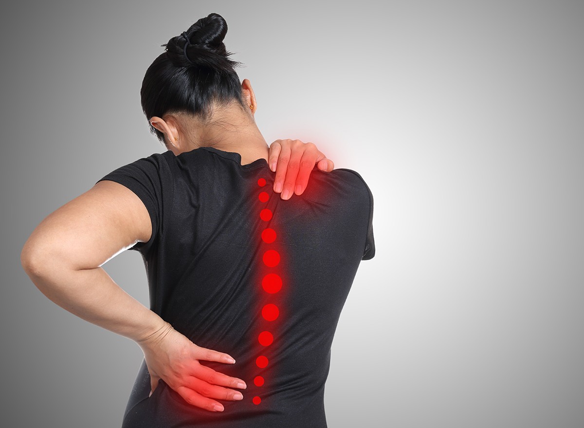 A woman with a curved spine