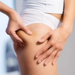 Plastic Surgeons Share the Best Ways to Reduce Cellulite Without Surgery
