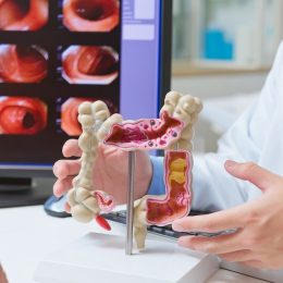 50% of Colon Cancer Cases in Young People Tied to 1 Common Factor, Researchers Discover