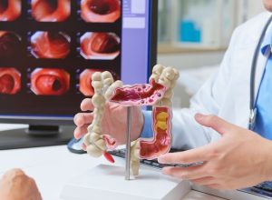 50% of Colon Cancer Cases in Young People Tied to 1 Common Factor, Researchers Discover