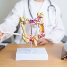 Doctors Say This Cheap Drug May Be a "Game Changer" for Preventing Colon Cancer