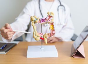 Doctors Say This Cheap Drug May Be a "Game Changer" for Preventing Colon Cancer