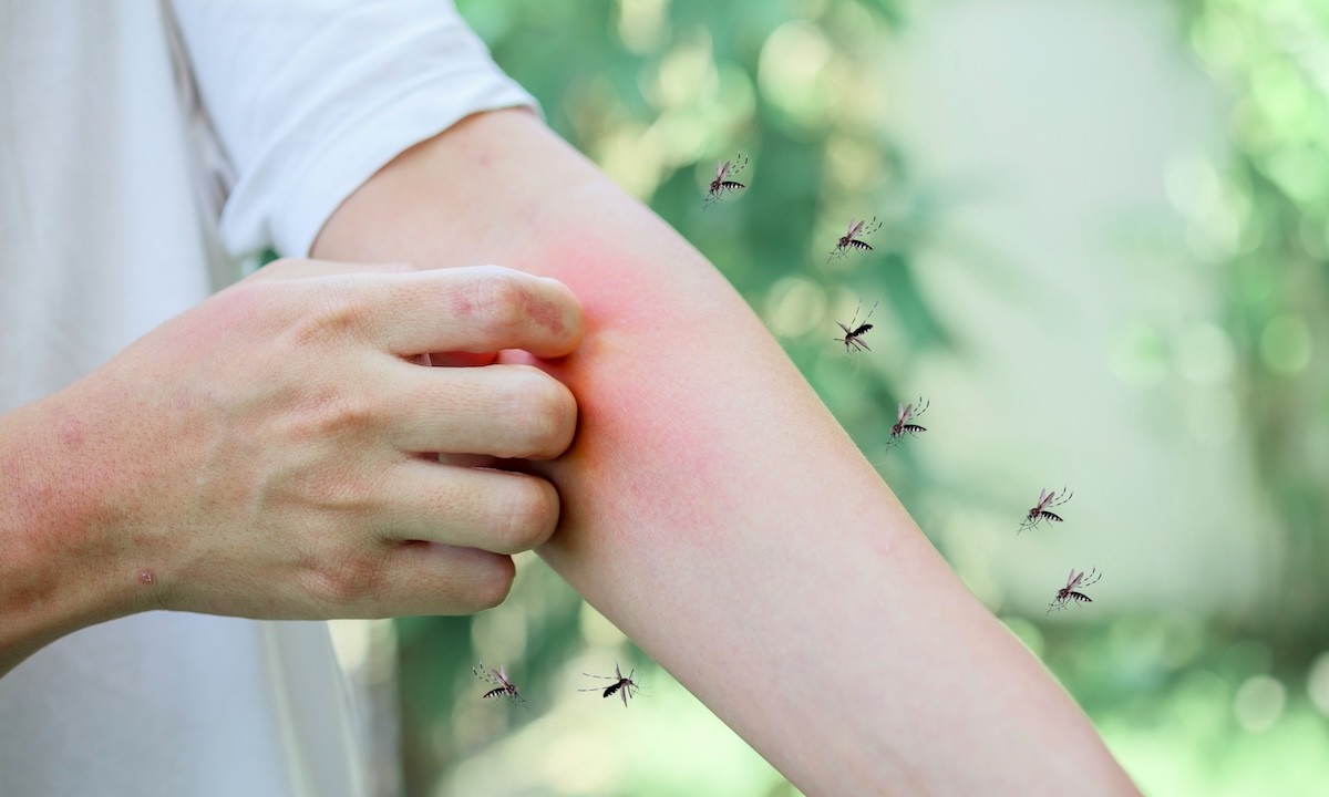 7 Reasons Mosquitoes Love You—And Not Everyone Else—Science Says