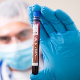 blurred image of a doctor in a mask and gloves holding a hantavirus blood test